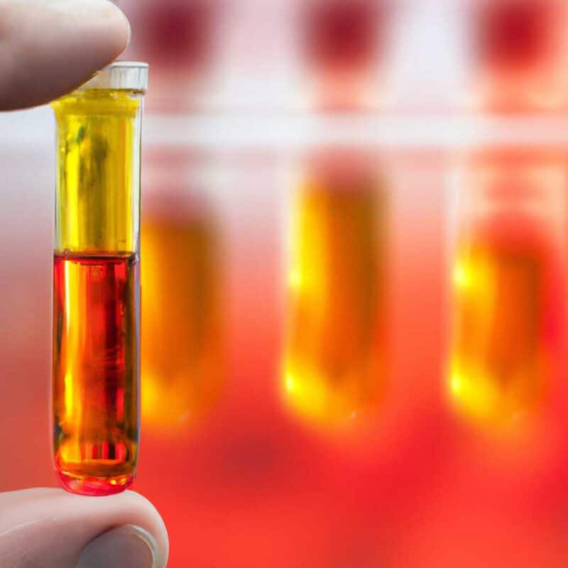BioMérieux Microbiology
