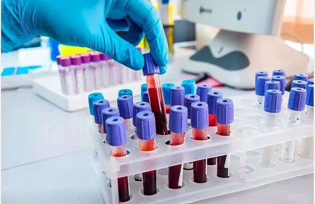 Tilia Medical - Laboratuvar Kurulumunun İncelikleri - Laboratuvar Kurulumuna Genel Bakış