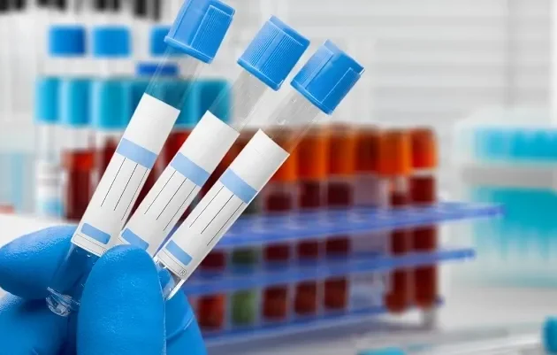 Tilia Medical - Kan Testi Ne Kadar 2025 Kan Testi Fiyatları