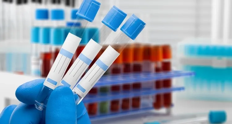 Tilia Medical - Kan Testi Ne Kadar 2025 Kan Testi Fiyatları