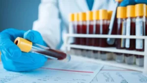 Tilia Medical - Kan Testi Ne Kadar 2025 Kan Testi Fiyatları