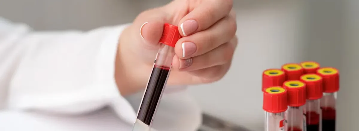 Tilia Medical - Kan Verince Hangi Sonuçlar Çıkar