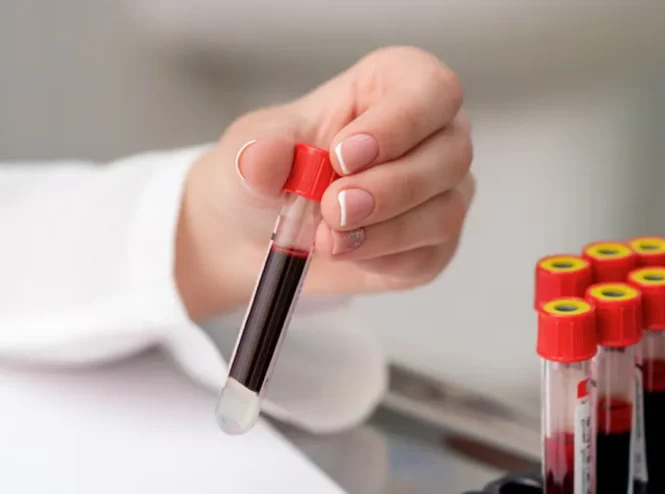 Tilia Medical - Kan Verince Hangi Sonuçlar Çıkar