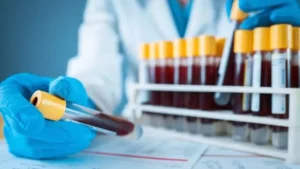 Tilia Medical - Laboratuvarda Kan Tahlili Nasıl Yapılır Adım Adım Rehber