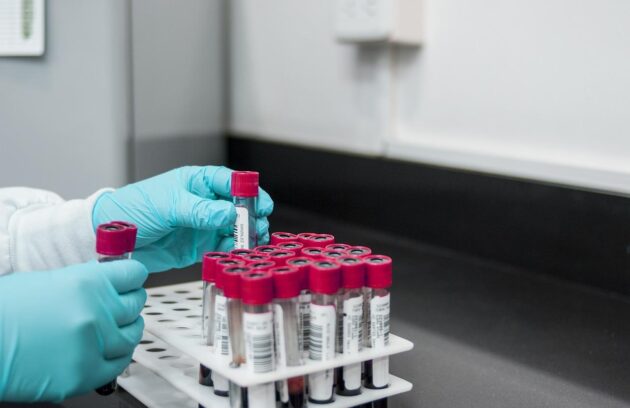 laboratuvar cihazlari nelerdir What Are Laboratory Devices?