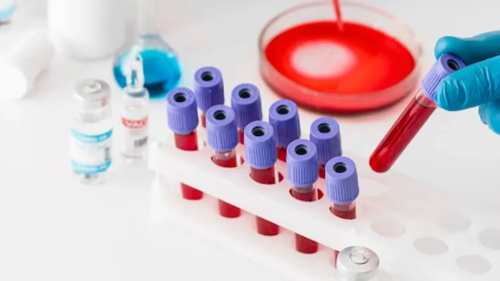 Tilia Medical - Kan Grubu Test Kiti – Pratik ve Hızlı Kan Grubu Belirleme