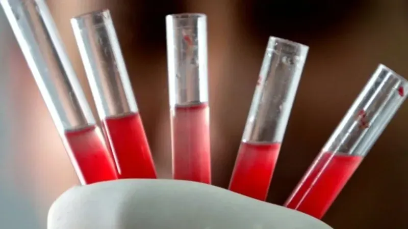 Tilia Medical - Kan Grubu Test Kiti – Pratik ve Hızlı Kan Grubu Belirleme
