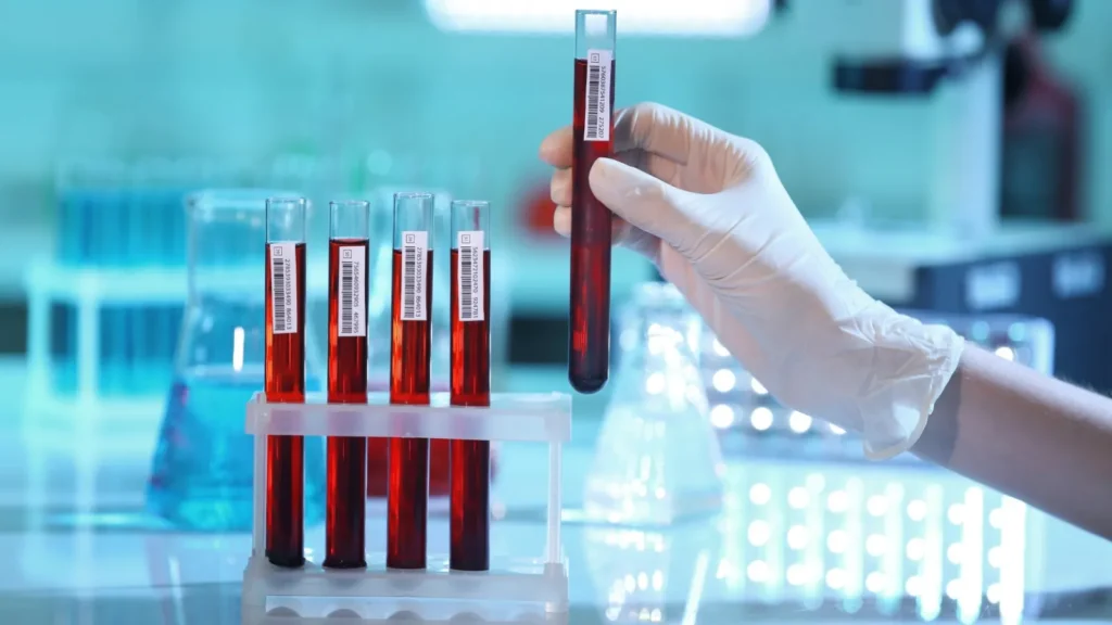Tilia Medical - Biyokimya Tahlili Nedir Biyokimya Testinde Neler Var