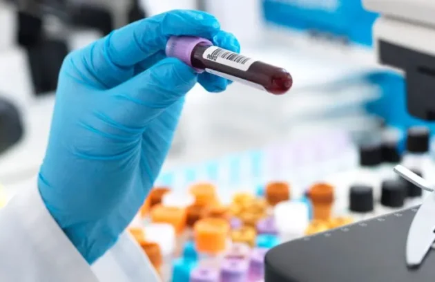 Tilia Medical - Biyokimya Tahlili Nedir Biyokimya Testinde Neler Var