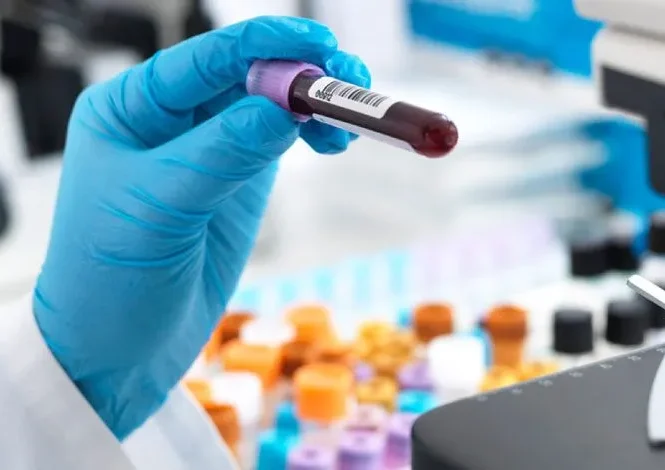 Tilia Medical - Biyokimya Tahlili Nedir Biyokimya Testinde Neler Var