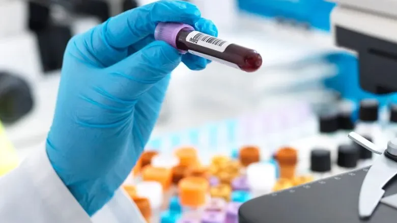 Tilia Medical - Biyokimya Tahlili Nedir Biyokimya Testinde Neler Var