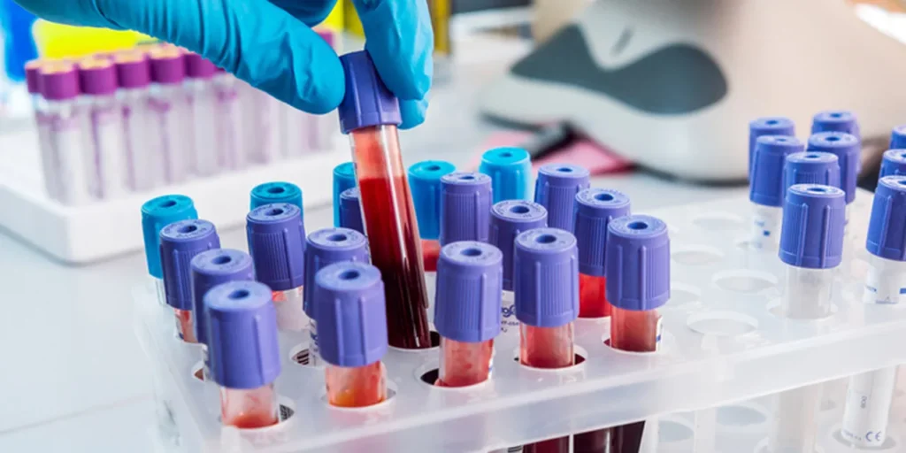 Tilia Medical - Biyokimya Tahlilleri İçin Uygun Test Kitleri