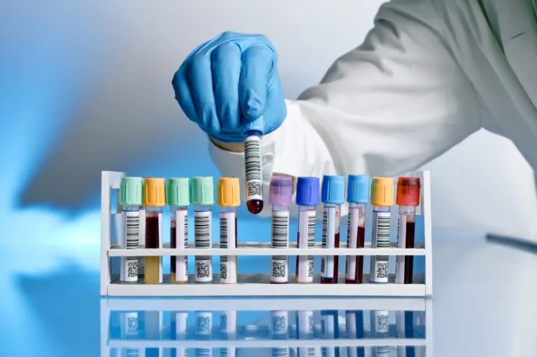 Tilia Medical - Biyokimya Tahlilleri İçin Uygun Test Kitleri