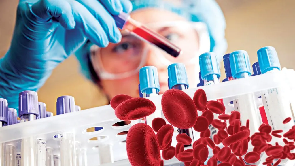 Tilia Medical - Biyokimya Tahlilleri İçin Uygun Test Kitleri