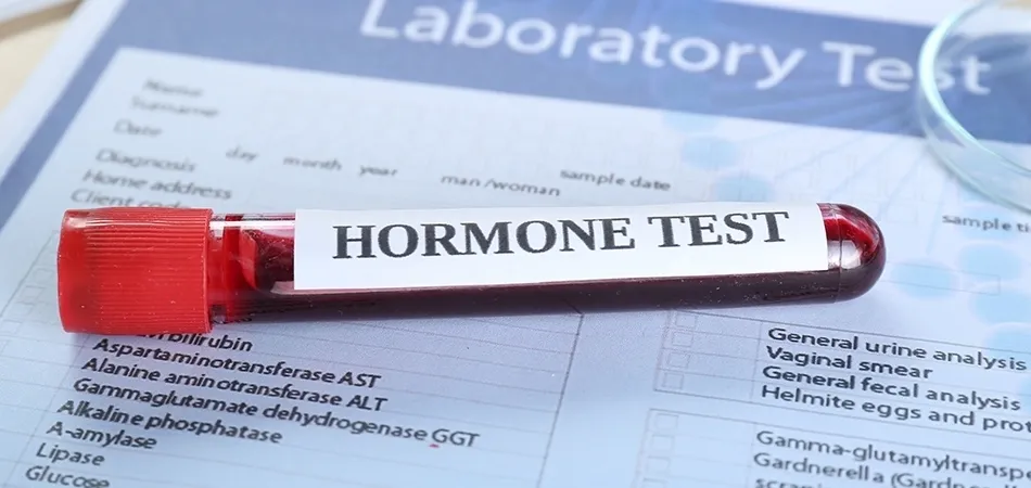 Tilia Medical - Hormon Testi Nedir Hormon Testi Nasıl Yapılır