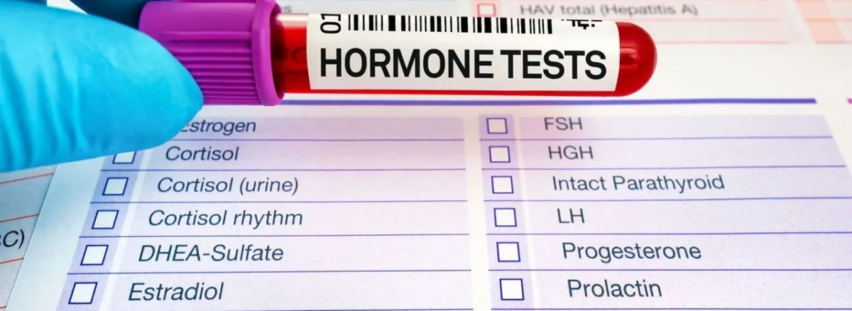 Tilia Medical - Hormon Testi Nedir Hormon Testi Nasıl Yapılır