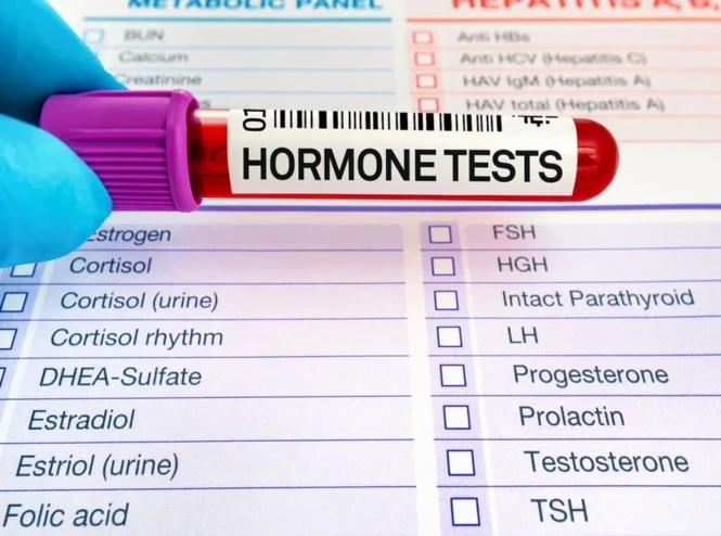 Tilia Medical - Hormon Testi Nedir Hormon Testi Nasıl Yapılır