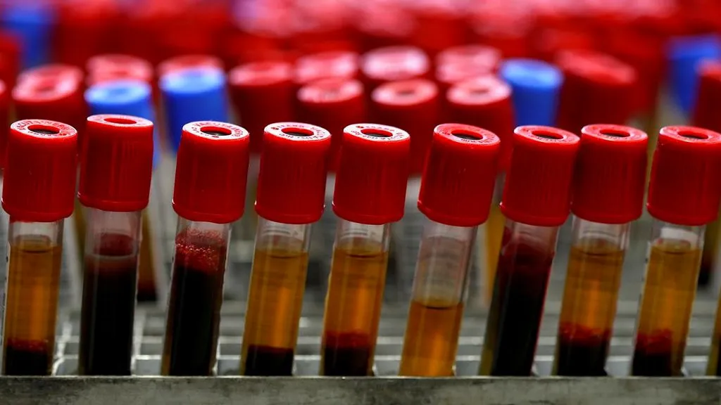 Tilia Medical - Kan Grubu Test Kiti Fiyatları Ne Kadar