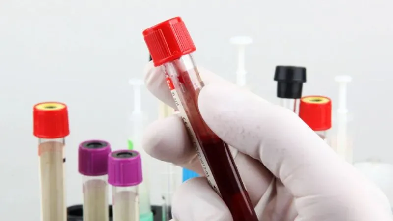 Tilia Medical - Kan Grubu Test Kiti Fiyatları Ne Kadar