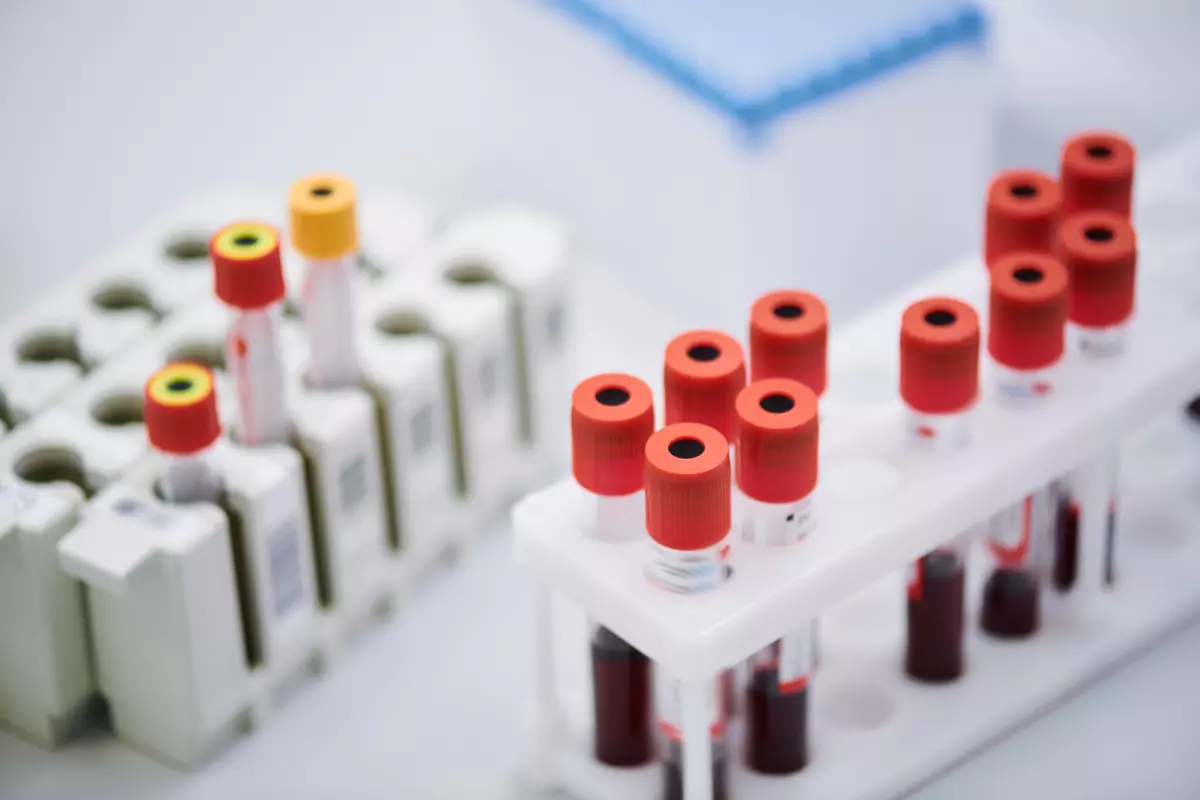 Tilia Medical - Kan Grubu Test Kiti Fiyatları Ne Kadar