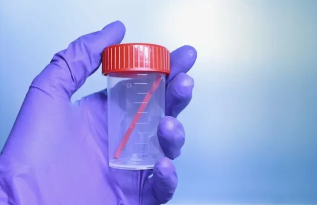 Gaita Test Kiti Nedir Evde Kolay Bağırsak Sağlığı Testi Rehberi