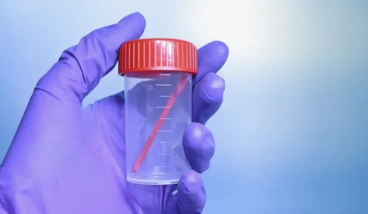 Gaita Test Kiti Nedir Evde Kolay Bağırsak Sağlığı Testi Rehberi