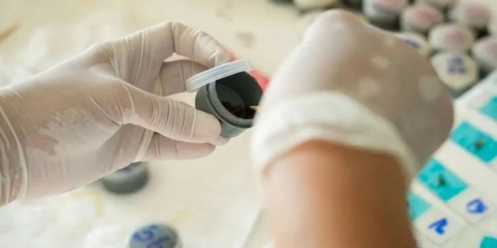 Gaita Test Kiti Nedir Evde Kolay Bağırsak Sağlığı Testi Rehberi